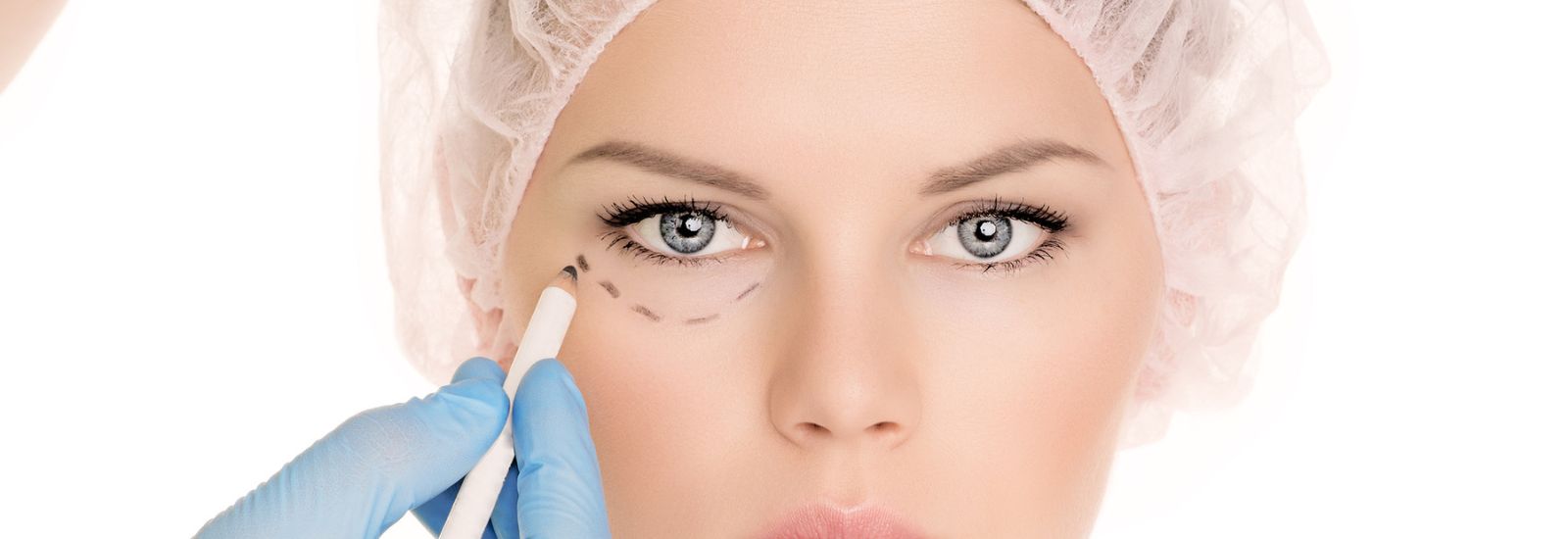 Patient at eyelid Surgery